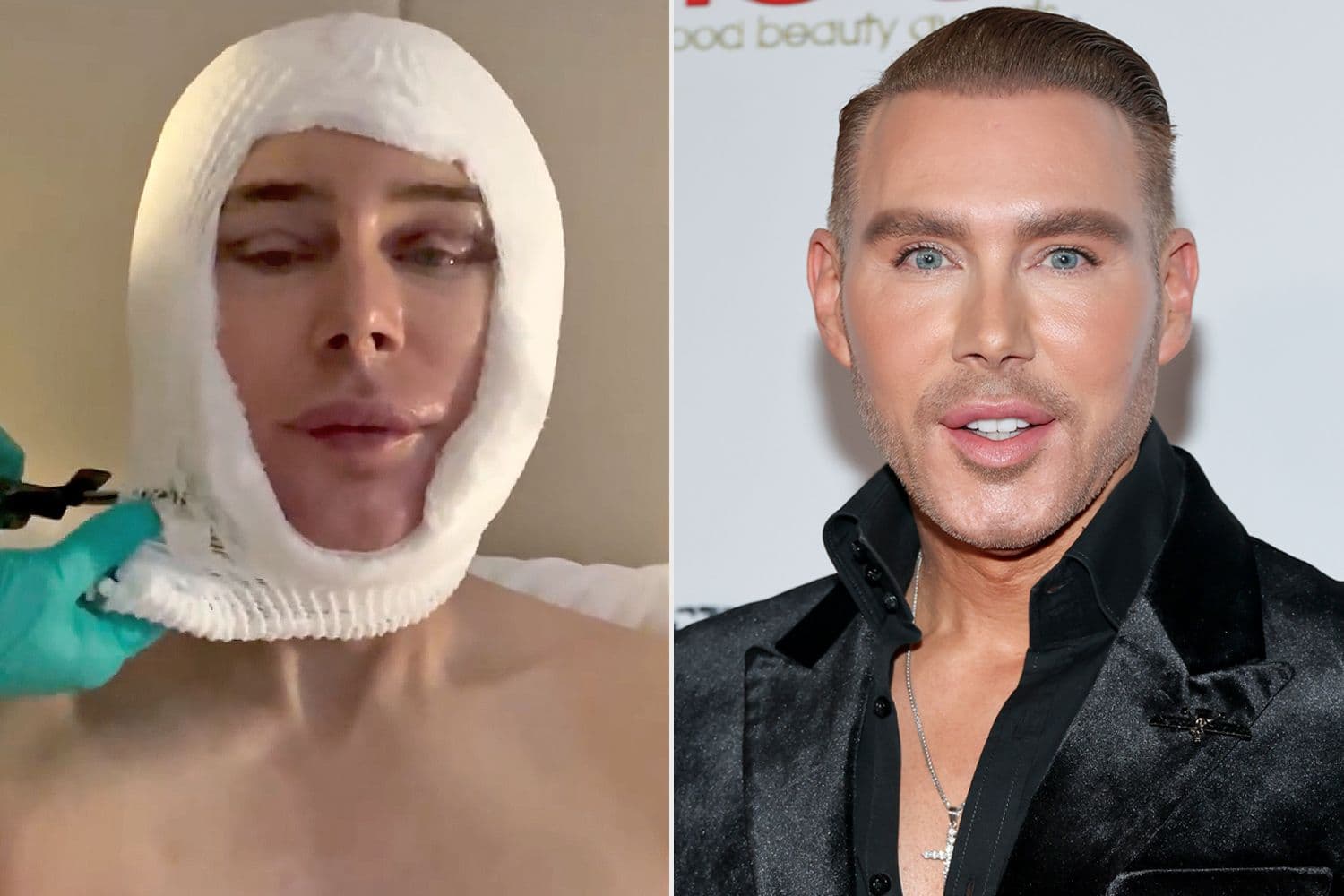 Makeup Artist Kristofer Buckle Lifts the Veil on His Dramatic Facial Transformation