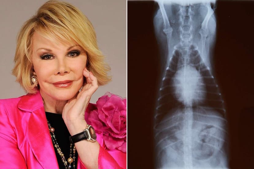Rare Joan Rivers Memorabilia Fetches Thousands at Auction