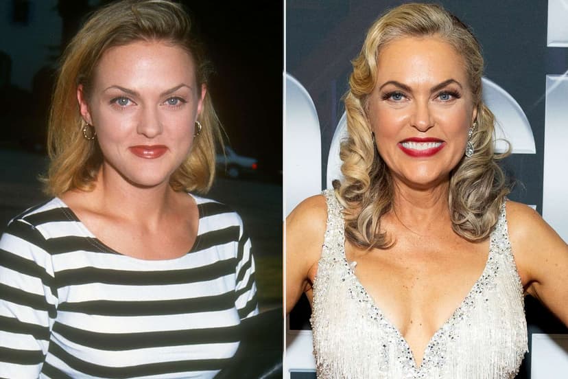 'Parent Trap' Star Elaine Hendrix Dances Through Injuries on 'Dancing with the Stars'