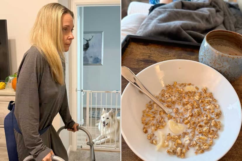 Reality Star Kate Gosselin Fractures Leg in Freak Accident with Pet Dog