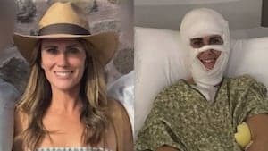 Acid Attack Survivor Faces Million-Dollar Medical Bills