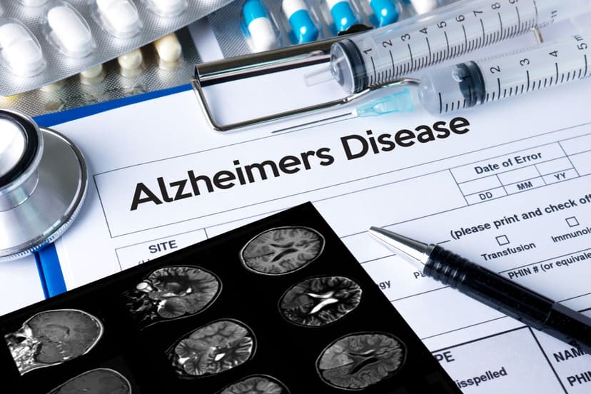 New Alzheimer's Clues: Midlife Health Key