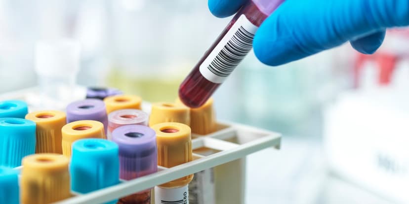 Beyond LDL: Is ApoB the Key Heart Marker?