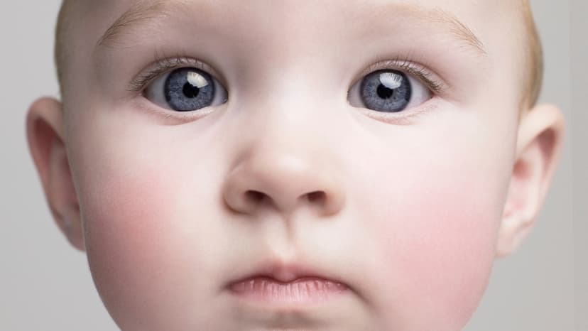 Dementia Roots Found in Childhood, Study Reveals