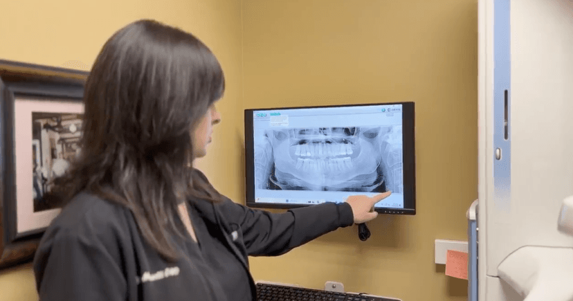 Routine dental visit saves patient from stroke