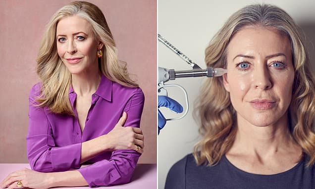 My Face Holds 7 Teaspoons of Filler: An MRI Investigation