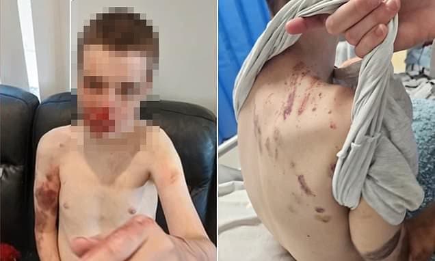 Disabled Man Brutalized in NDIS Care Home