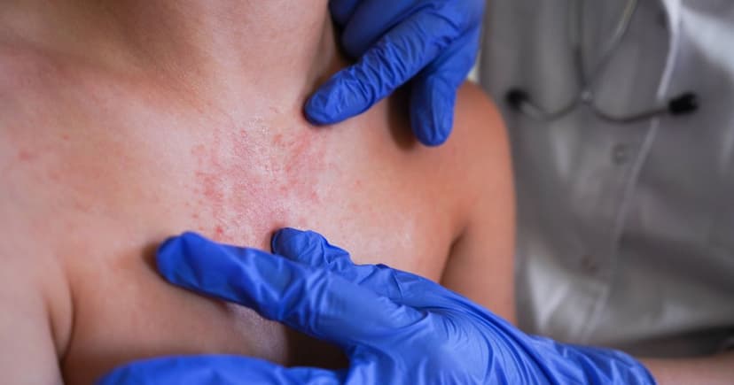 Old Diseases Making a Comeback: Are You Protected?