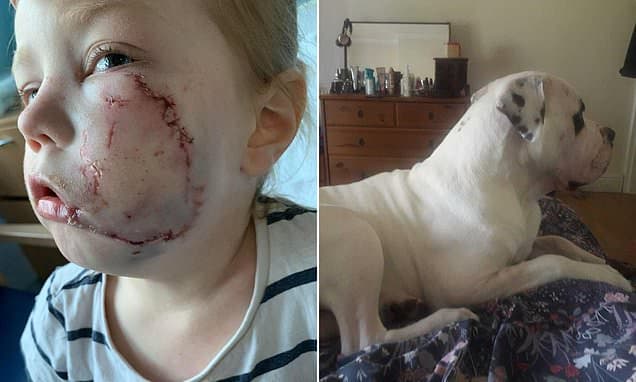 Dog Owner Avoids Jail After Brutal Child Attack
