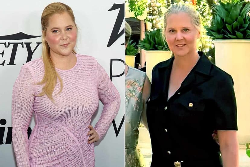 Amy Schumer Embraces Honesty in Dramatic Weight Loss Journey