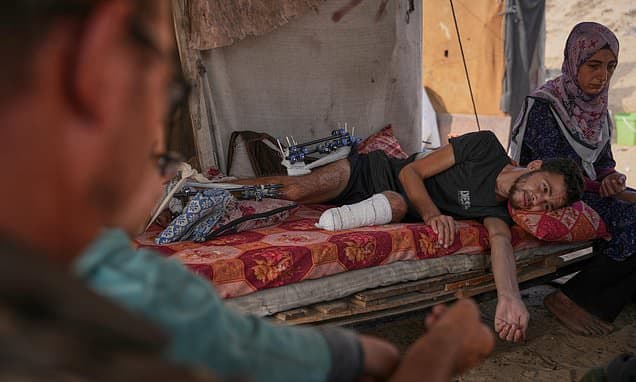 Gaza Amputees: Limbs Lost, Dreams Deferred