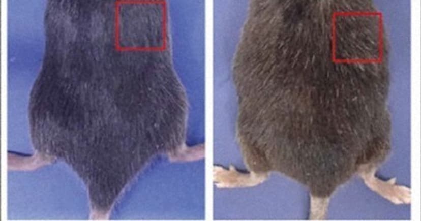 Gray Hair: Your Body's Cancer Defense?