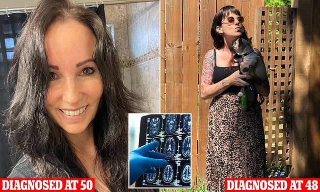 Small Heads, Lower Education Raise Dementia Odds