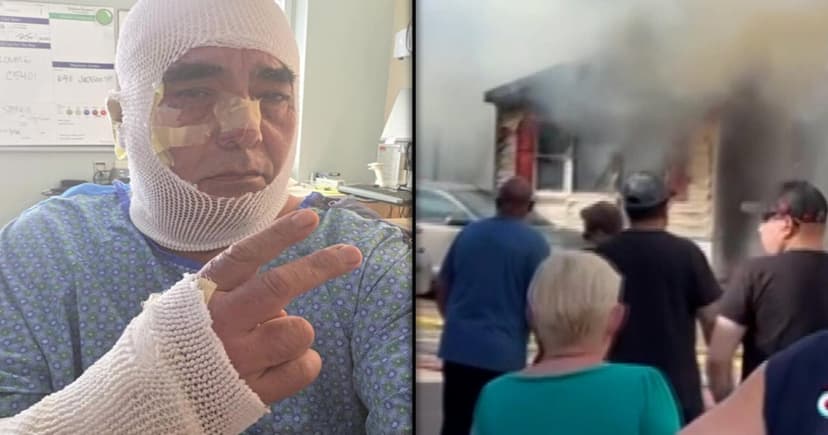 Hero Service Dog Dies in House Fire