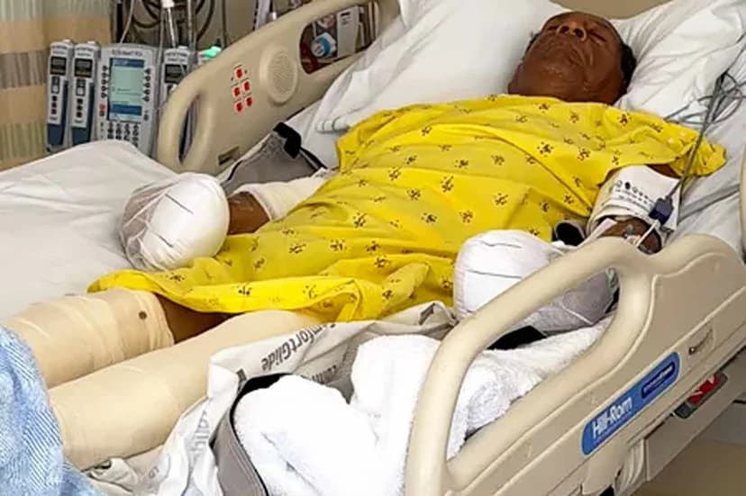 Elderly Tamale Vendor Critically Injured in LA Crash