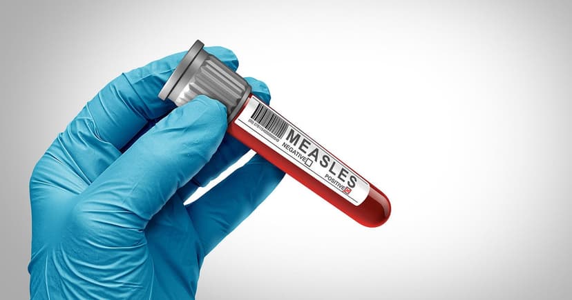 Exposure Alert: Measles Case in Southeast Michigan