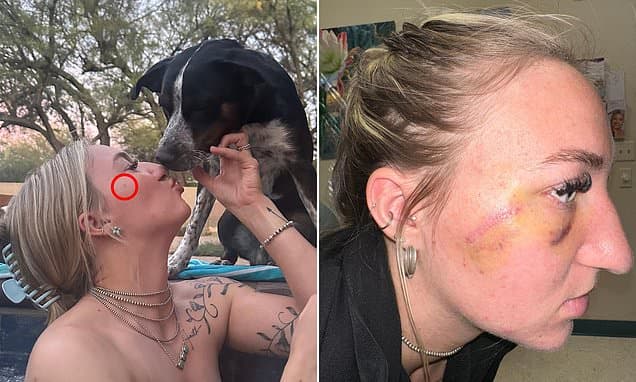 Mole on Cheek Diagnosed as Deadly Melanoma
