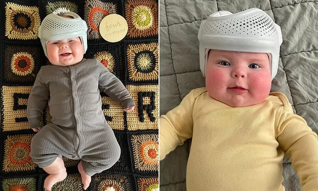 Mom Defends Twins' 23-Hour Helmet Rule