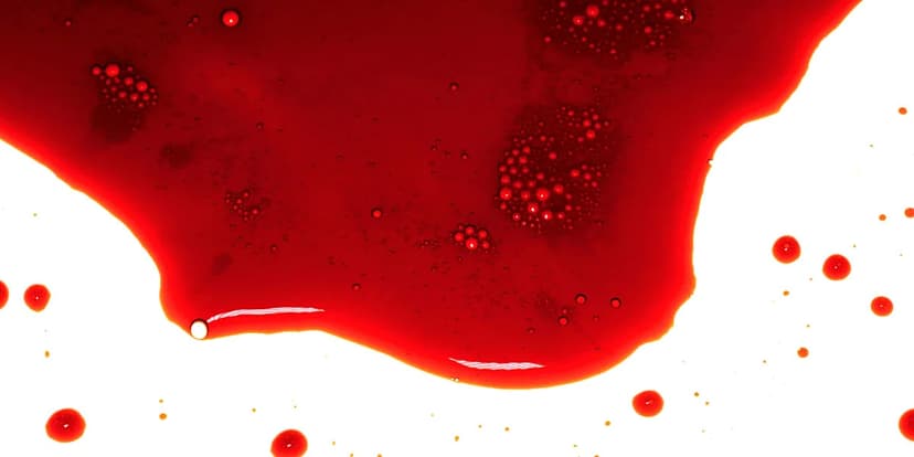 Rare Blood Type B(A) Found in Only Three Individuals