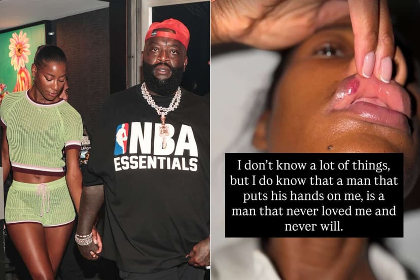 Rick Ross Accused of Physical Abuse by Ex