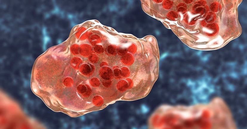 SF Confirms First Measles Case Since 2019