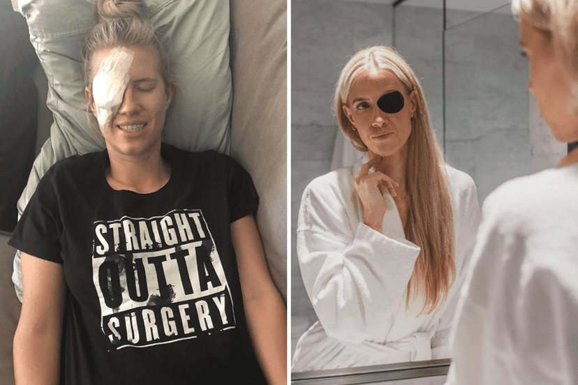 Snowboarder Loses Eye, Finds Purpose