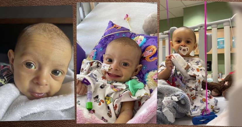 Rare Split Liver Transplant Saves Two