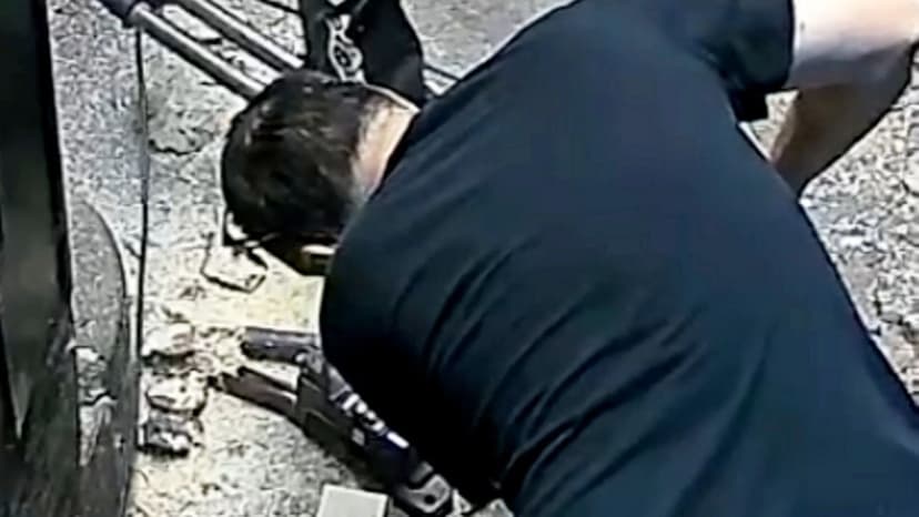 Grim Footage: Thumb Severed, Reattached in 10-Hour Surgery