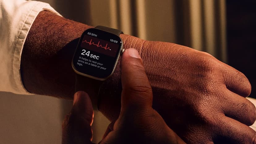 Apple Watch Unlocks Trove of Health Insights for Users
