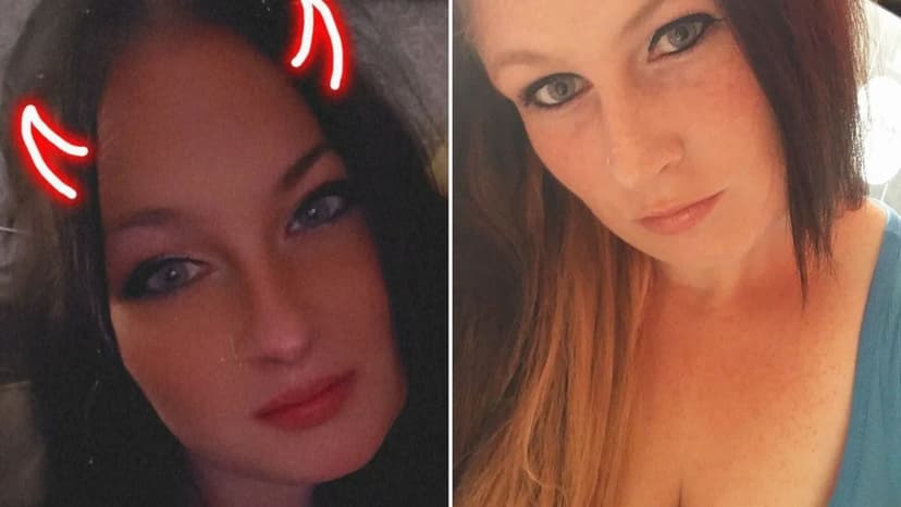 Bottle Attack Leaves Woman Scarred for Life