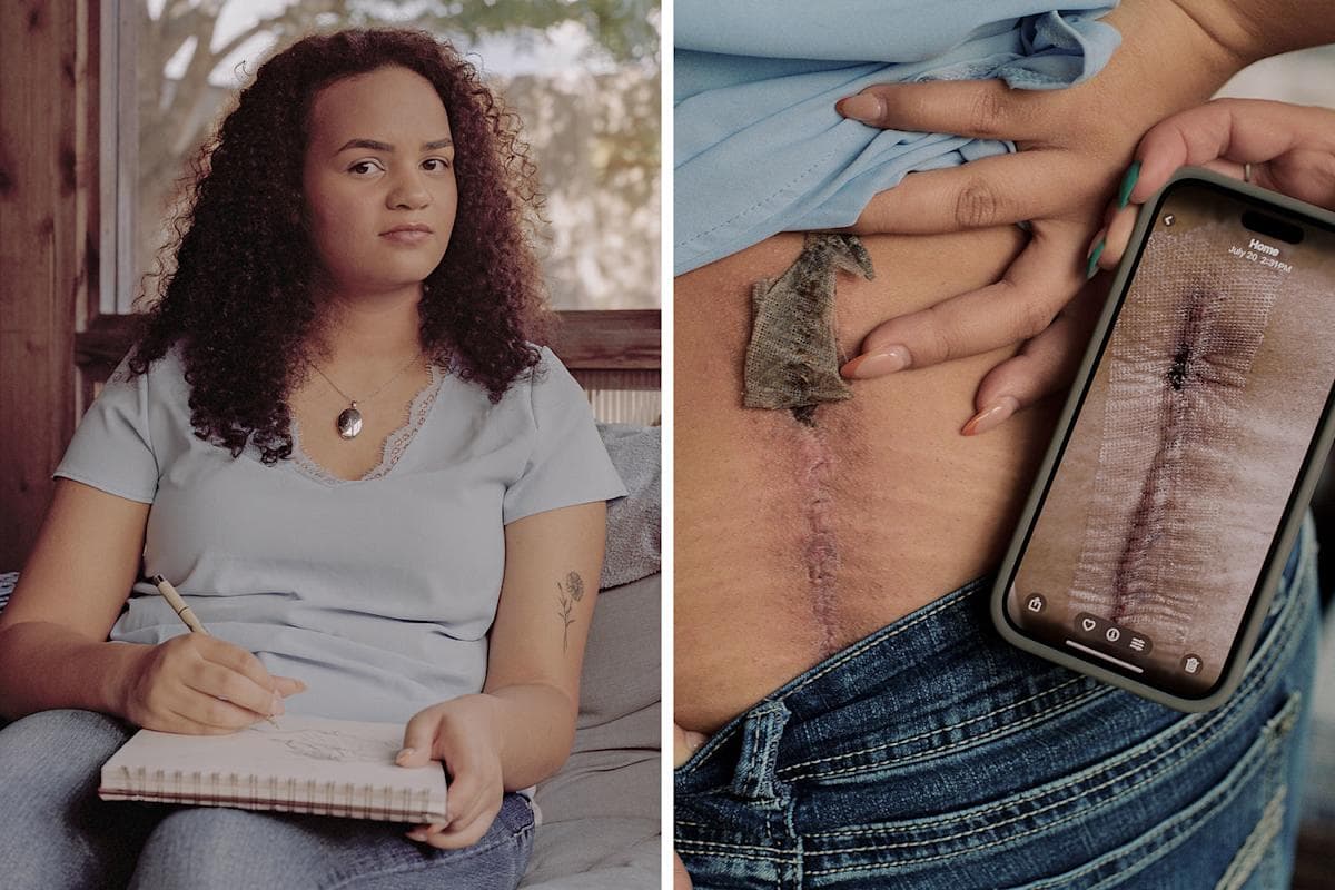 Denied Spine Surgery Leaves Texas Teen in Agony