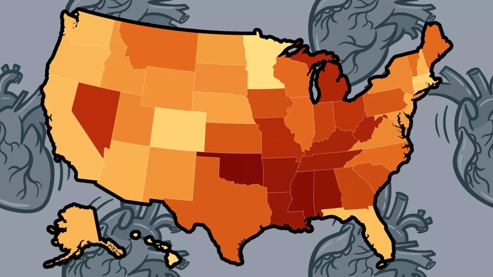 Heart Disease Mortality Soars in Southern, Midwestern States