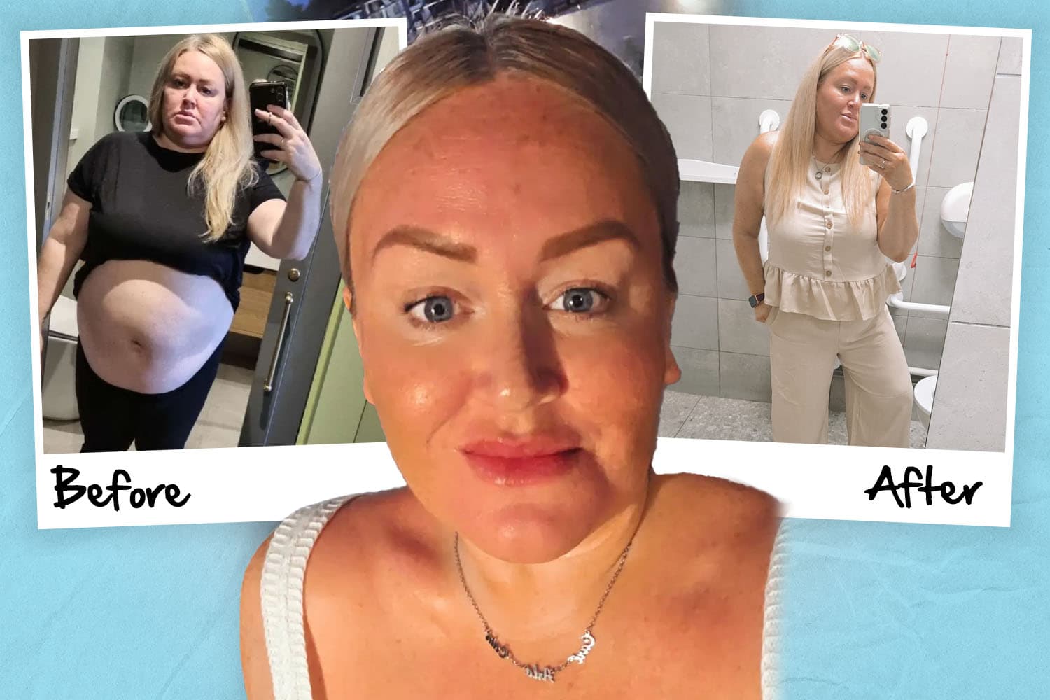 Mum Loses 4 Stone on Mounjaro, But Warns of Shocking Side Effects