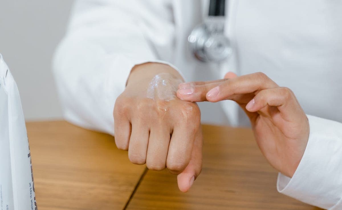 Dermatologists Reveal Secrets to Taming Eczema Outbreaks