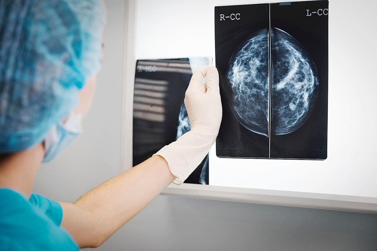 Aggressive Breast Cancers May Exploit Neighboring Fat Cells to Grow