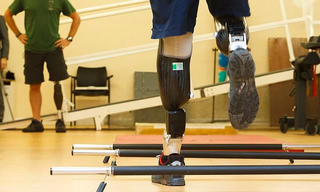 Data-Driven Prosthetics Slash NHS Waiting Times, Boost Comfort