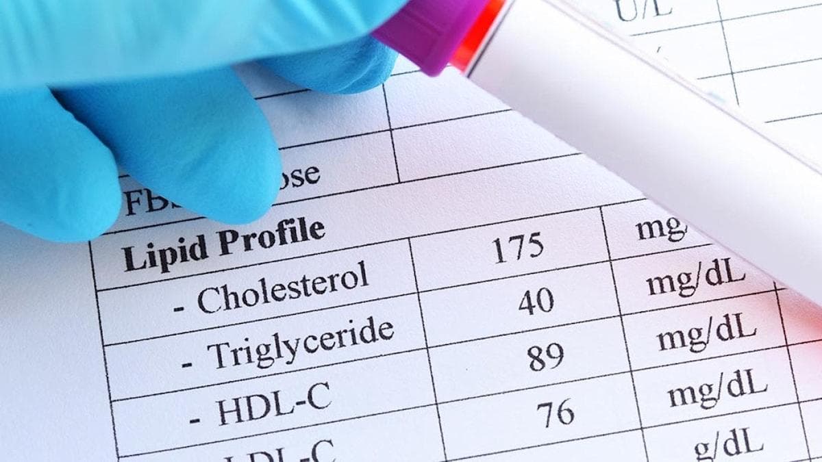 Cutting-Edge Therapies Offer New Hope for Lowering Cholesterol