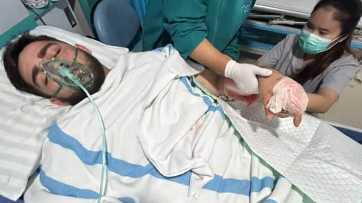 Queensland Father Fights for Life After Devastating Bali Scooter Crash