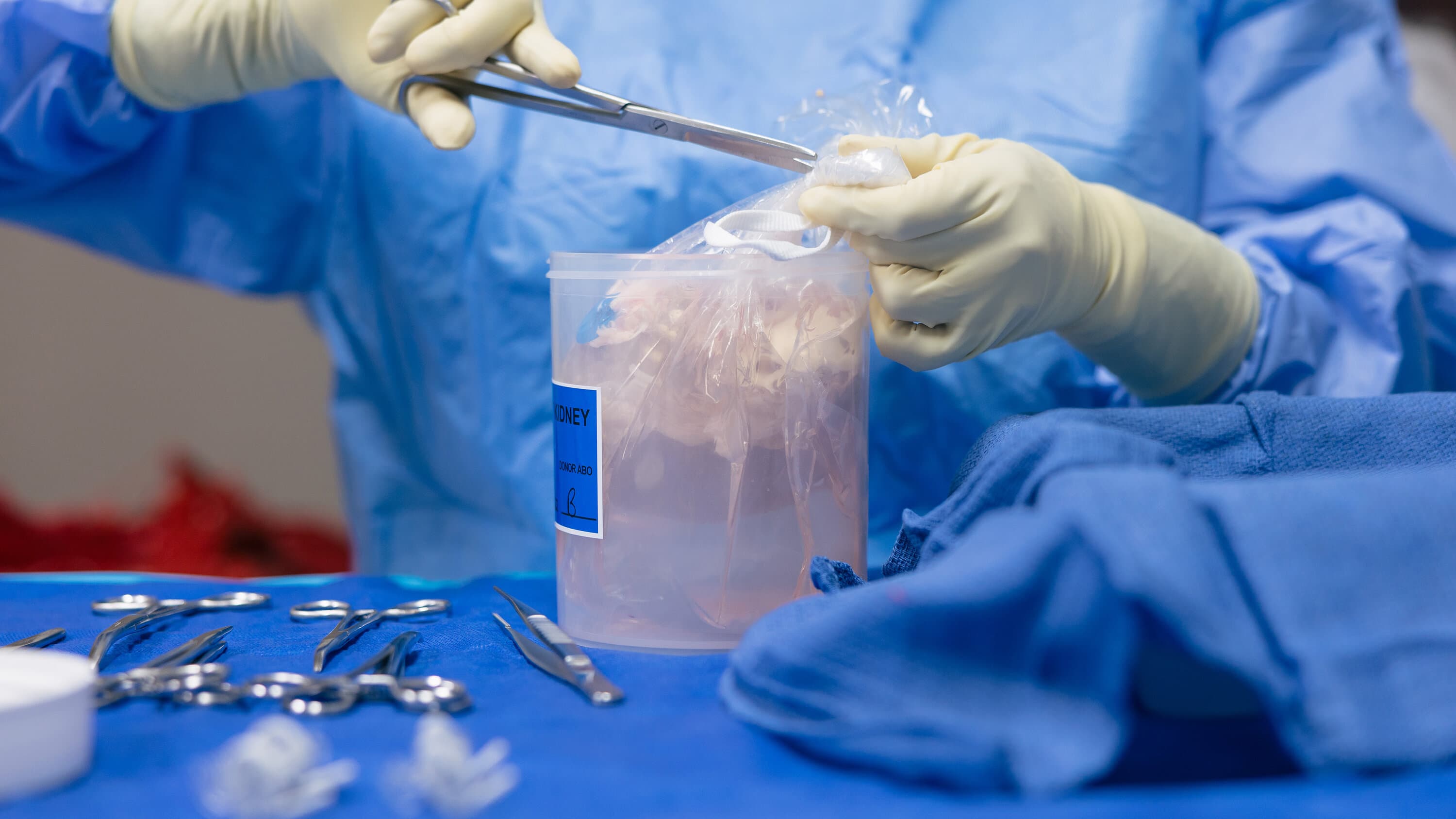 Organ Transplant Surge Puts Donors at Grave Risk