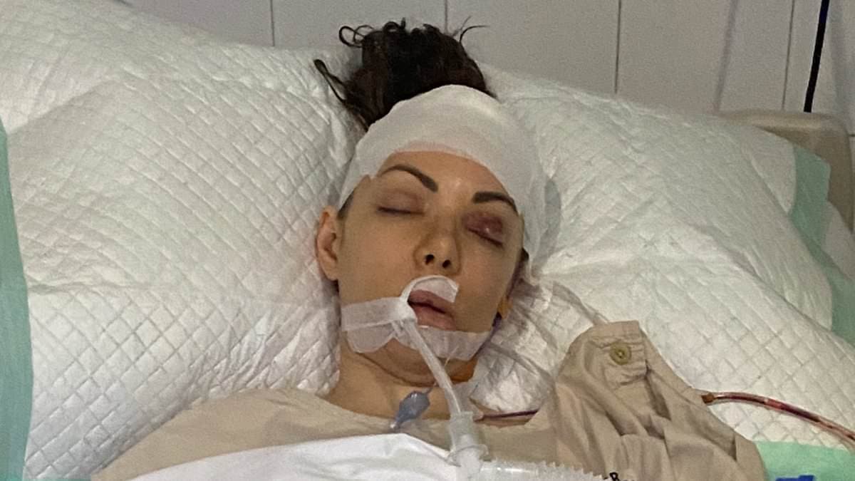 Melbourne Mom in Critical Condition After Bali Bike Crash, Insurance Denies Coverage