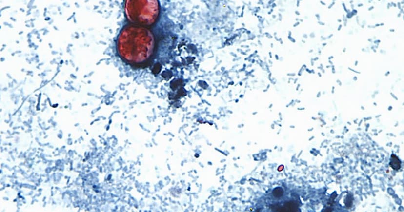 Lettuce Recall Grows: 20 States Hit by Parasite Outbreak