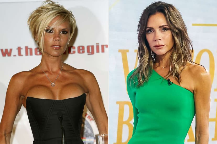 Victoria Beckham's Fashion Mentor Encouraged Her to Remove Breast Implants