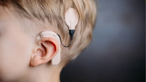 Rajasthan Hospital Pioneers AI Cochlear Implant