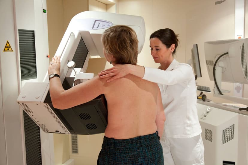 AI Sees Heart Risk on Mammograms
