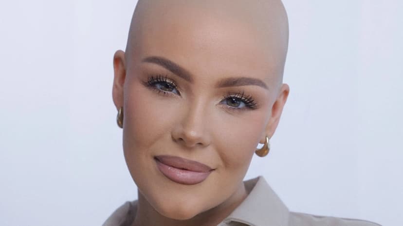 Alopecia Warrior: From Hair Loss to Wig Empire