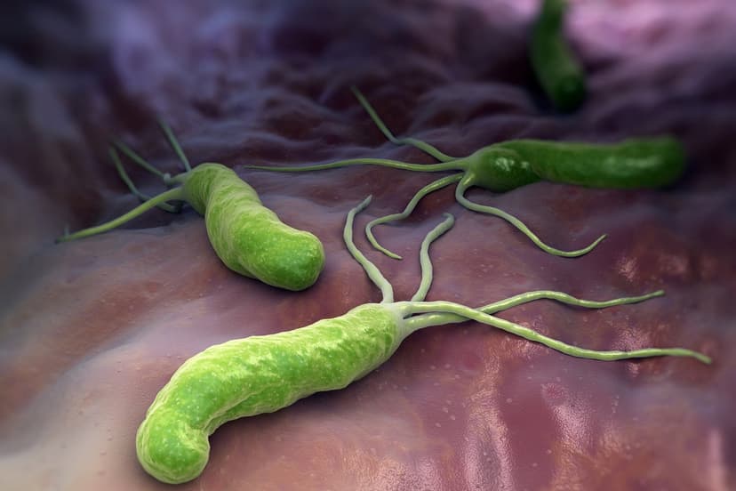 Stomach Bug Protein Fights Alzheimer's Plaque
