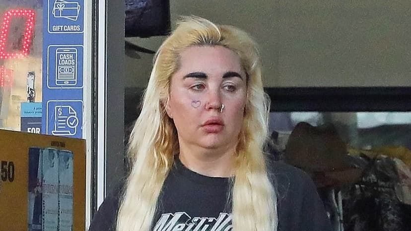 Amanda Bynes Flaunts Ozempic Weight Loss in LA