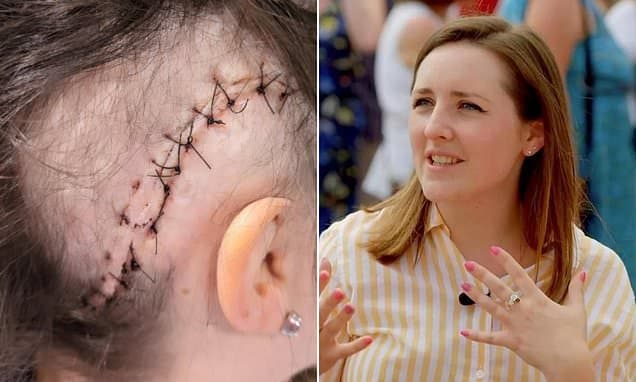 Antiques Roadshow Star's Brave Brain Surgery Post