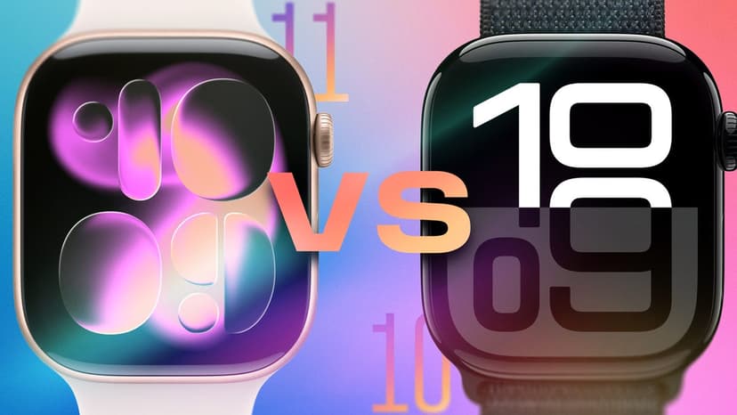 Series 11 vs Series 10: Is It Time to Upgrade?