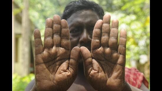 Hidden Danger: Arsenic Poisons Millions Daily